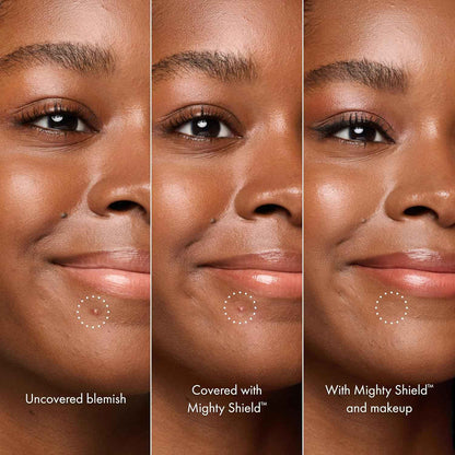 HERO COSMETICS Mighty Shield™ Liquid Patch Invisible Blemish Protectant for Pimples, Zits, and Blemish Wounds. Fast-Drying and Protects Blemishes from Makeup, Sunscreen