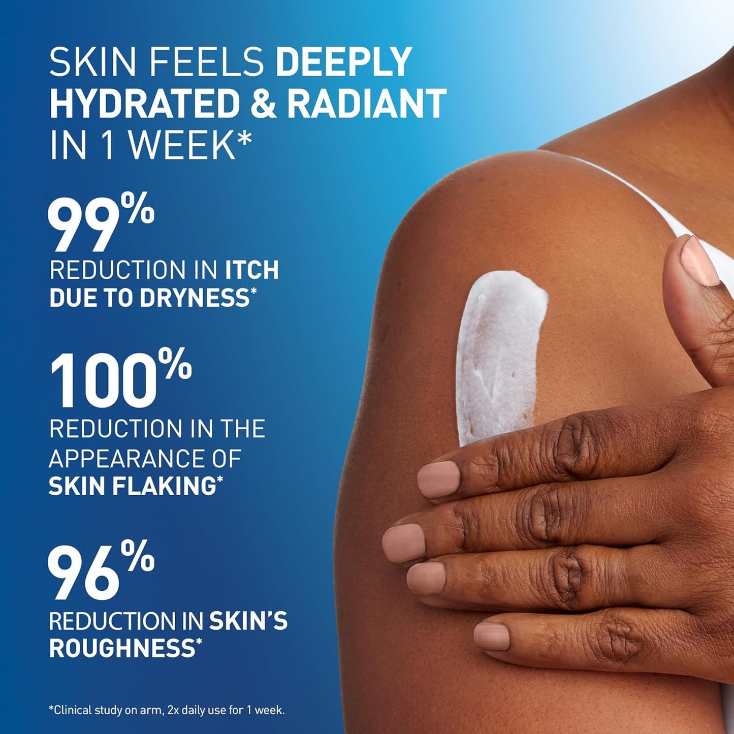 CeraVe_Intensive_Moisturizing_Lotion,_3_Essential_Ceramides_+_Hydro-Urea_+_Shea_Butter,_Body_Lotion_for_Very_Dry_Skin,_Relieves_Rough,_Tight,_Red_&_Itchy_Skin,_Non-Greasy_Hydrating_Cream,_19oz
