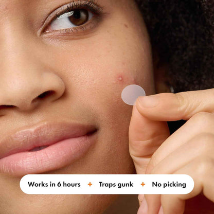 Mighty Patch™ Variety Pack from Hero Cosmetics - Hydrocolloid Acne Pimple Patches for Covering Zits and Blemishes, Spot Stickers for Face and Skin, Korean Skin Care