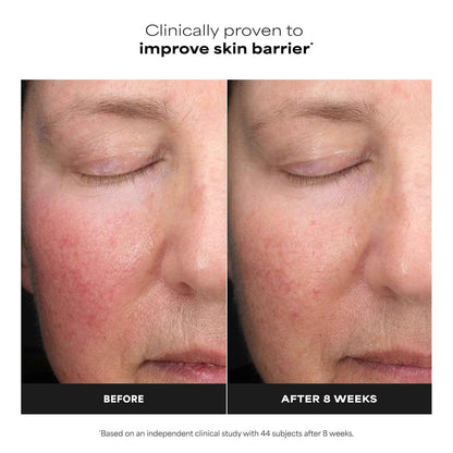Paula’s Choice 6% Mandelic Acid + 2% Lactic Acid Exfoliant, Gentle Daily AHA Exfoliation for Discoloration, Bumpy Texture & Radiance, for Sensitive Skin, Fragrance-Free