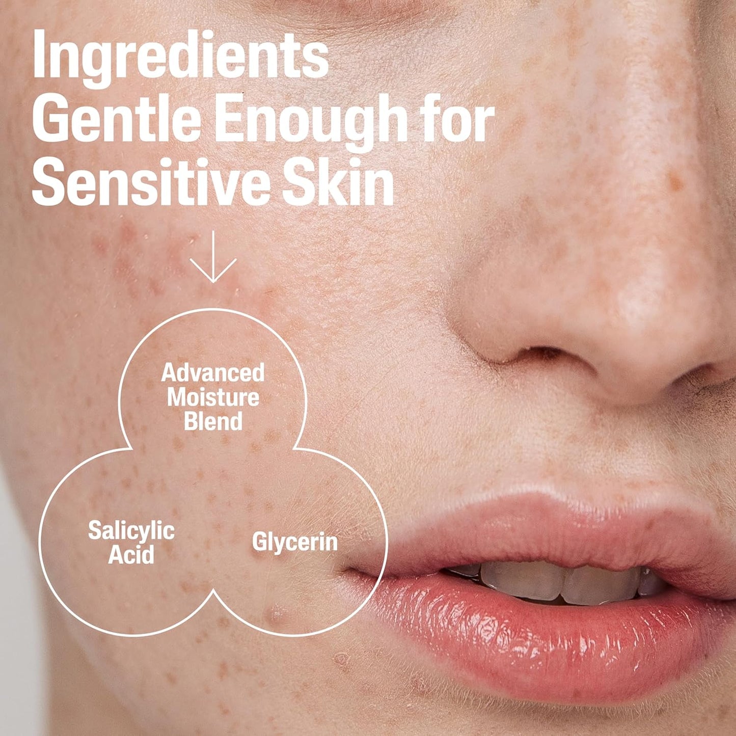 Cetaphil_Gentle_Clear_Pore_Clearing_Acne_Cleanser,_Foaming_Gel_Cleanser_for_Sensitive,_Acne-Prone_Skin,_8_Fl_Oz_Pump_Bottle,_2%_Salicylic_Acid,_Gently_Exfoliates,_Dermatologist_Recommended_Brand