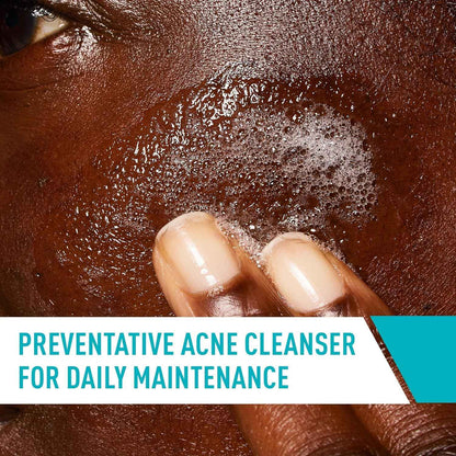 CeraVe Acne Treatment Face Wash, Salicylic Acid Cleanser with Purifying Clay, Niacinamide, and Ceramides, Pore Control and Blackhead Remover