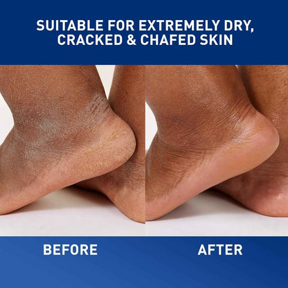 CeraVe Healing Ointment, Hydrating Skin Protectant With Petrolatum, Hyaluronic Acid & Ceramides, Face & Body Skin Barrier Repair For Cracked, Chafed, Dry Skin, Fragrance Free & Lanolin Free
