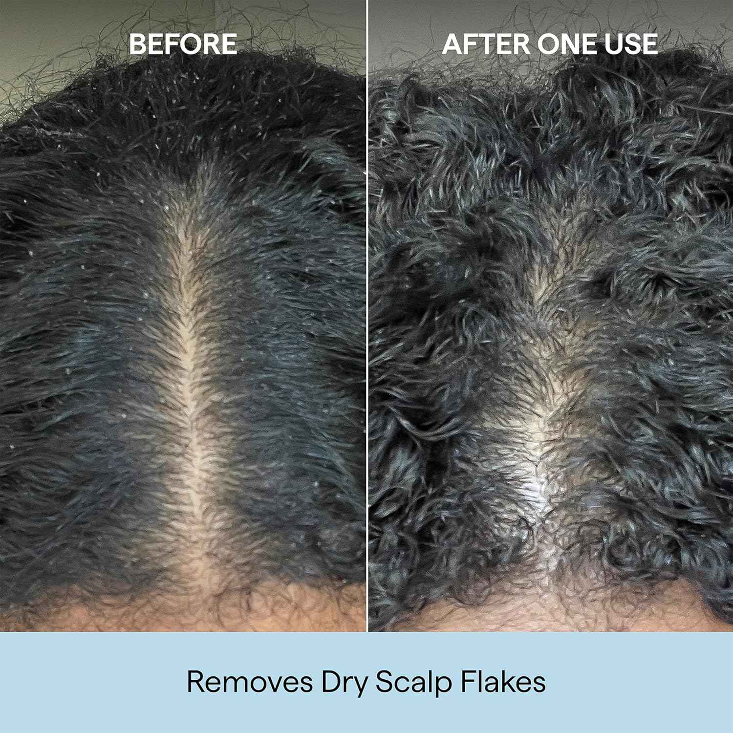 Briogeo Scalp Revival Charcoal + Coconut Oil Micro-Exfoliating Shampoo | Sulfate-Free Scalp Scrub for Dry, Itchy, or Oily Scalp | Detoxifying & Hydrating | Vegan & Cruelty Free