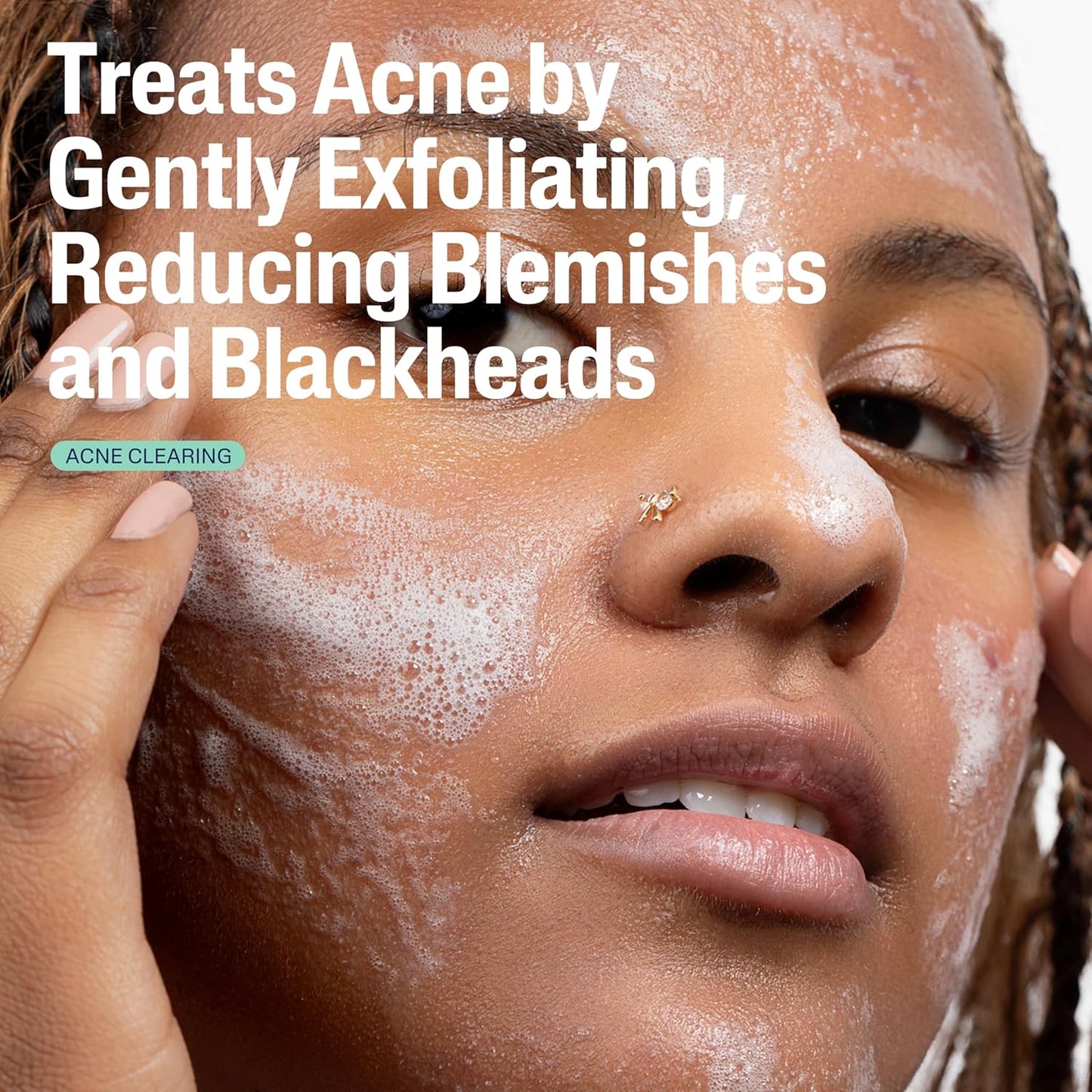 Cetaphil_Gentle_Clear_Pore_Clearing_Acne_Cleanser,_Foaming_Gel_Cleanser_for_Sensitive,_Acne-Prone_Skin,_8_Fl_Oz_Pump_Bottle,_2%_Salicylic_Acid,_Gently_Exfoliates,_Dermatologist_Recommended_Brand