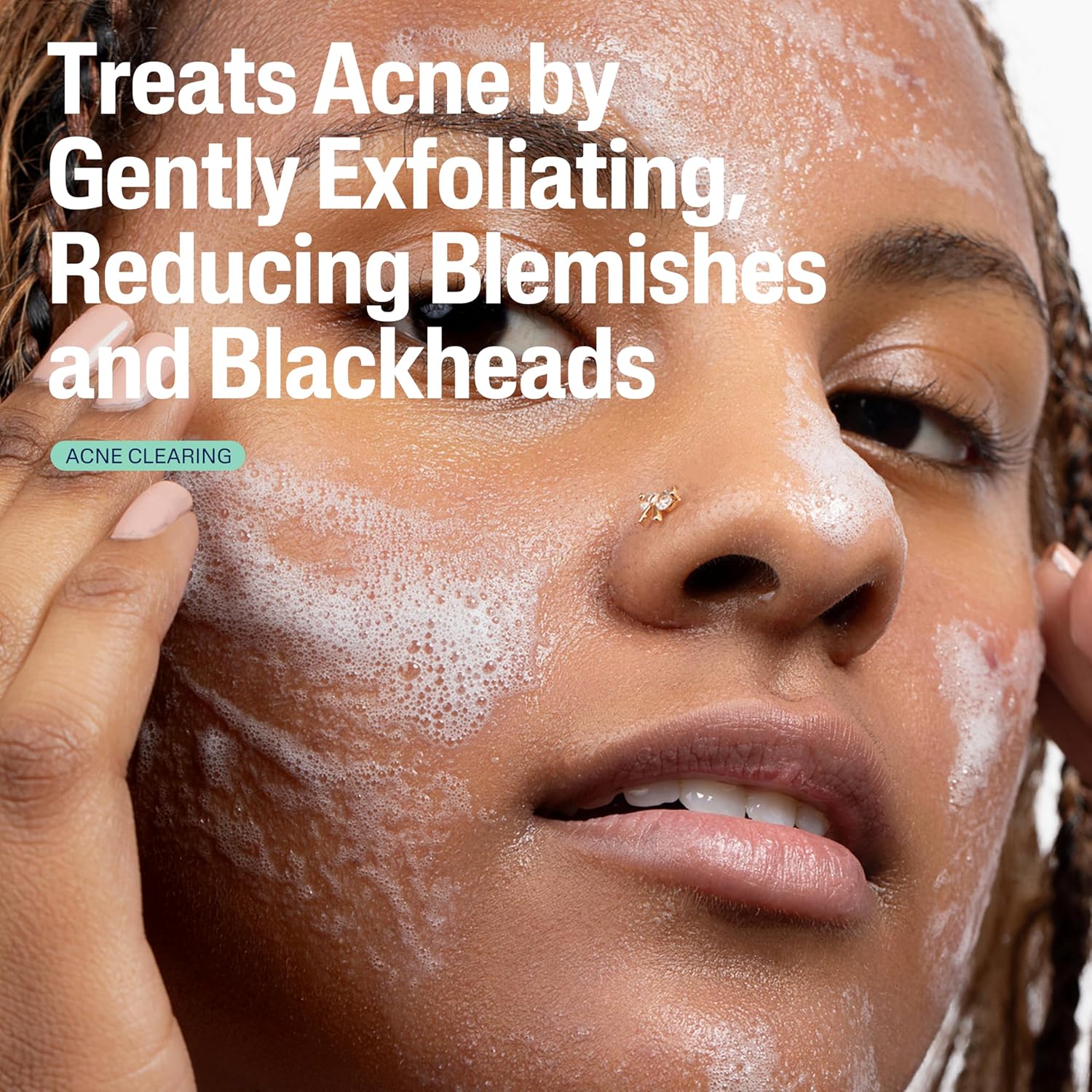 Cetaphil_Gentle_Clear_Pore_Clearing_Acne_Cleanser,_Foaming_Gel_Cleanser_for_Sensitive,_Acne-Prone_Skin,_8_Fl_Oz_Pump_Bottle,_2%_Salicylic_Acid,_Gently_Exfoliates,_Dermatologist_Recommended_Brand
