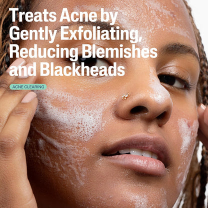Cetaphil_Gentle_Clear_Pore_Clearing_Acne_Cleanser,_Foaming_Gel_Cleanser_for_Sensitive,_Acne-Prone_Skin,_8_Fl_Oz_Pump_Bottle,_2%_Salicylic_Acid,_Gently_Exfoliates,_Dermatologist_Recommended_Brand