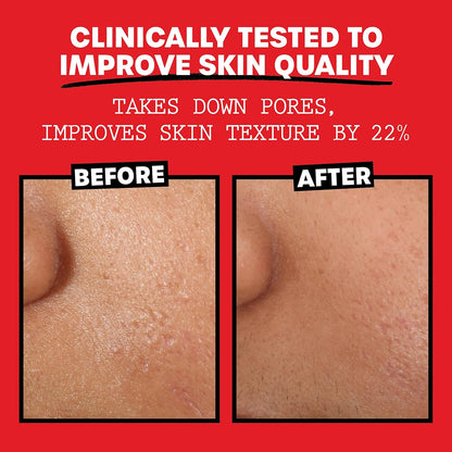 Thayers_Alcohol-Free_Rose_Petal_Witch_Hazel_Facial_Toner_for_Glowing_Skin,_Hydrating,_Refreshing_Toner_for_Normal_and_Combination(Skincare,_Comfort)