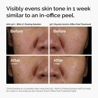 available in single bottle, peeling solution duo, and bright & hydrated serum duo bundles