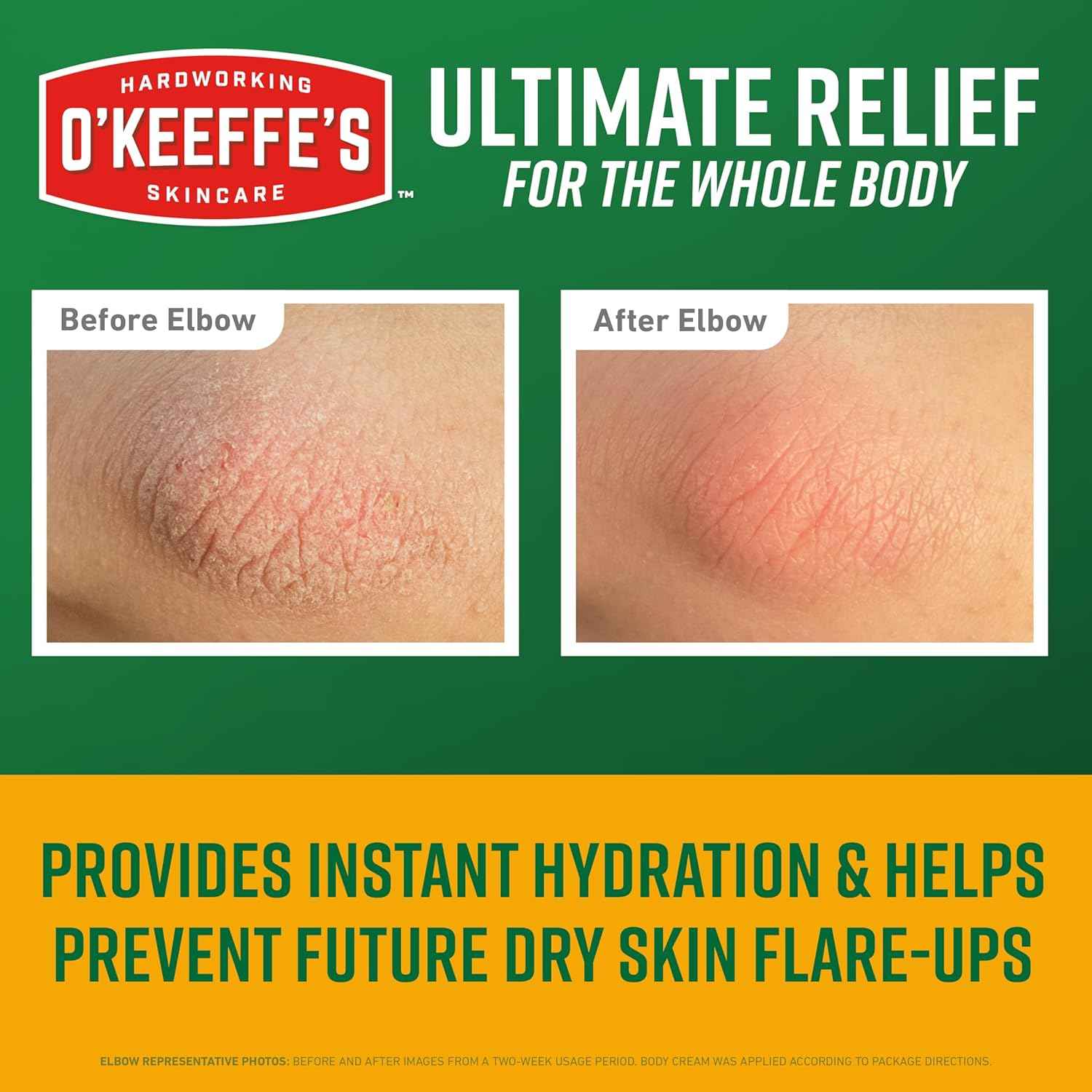 O'Keeffe's Skin Repair Body Cream – Nightly Hydration Ritual for Severe Dry Skin, 7oz Scent-Free Tube