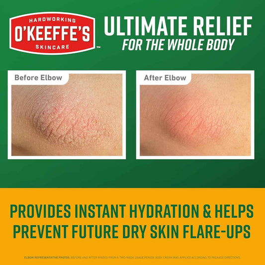 O'Keeffe's Skin Repair Body Cream – Nightly Hydration Ritual for Severe Dry Skin, 7oz Scent-Free Tube