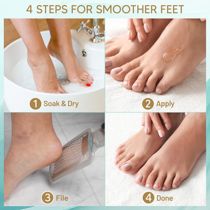 Extra_Strength_Callus_Remover_for_Feet_-_Callus_Remover_Gel_Foot_Scrubber_for_Dead_Skin_-_Professional_Pedicure_Foot_Spa_Essential,_6oz
