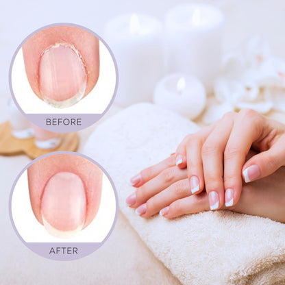 C_CARE_Sweet_Almond_Cuticle_Oil_For_Nails_-_Repairs_Cuticles_Overnight_-_Moisturizes_and_Strengthens_Nails_and_Cuticles_-_Dropper_&_Brush_included_-_2.5oz