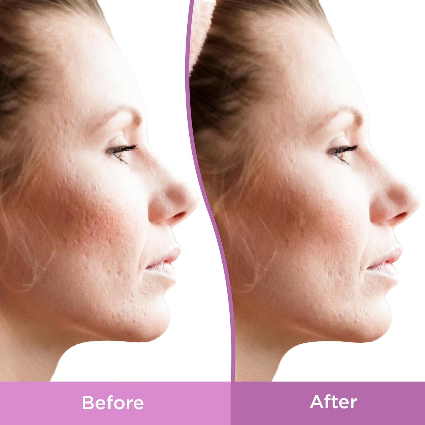 fragrance-free, non-comedogenic, paraben-free gentle formulation