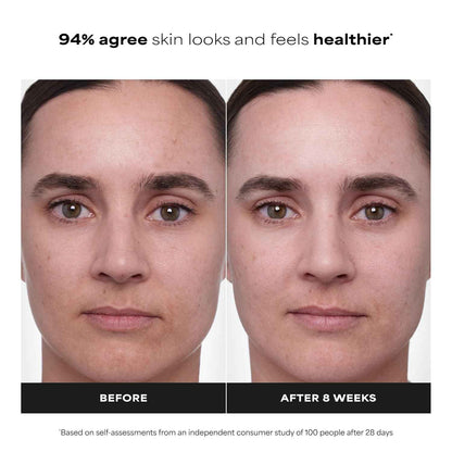 Paula's Choice CLINICAL 1% Retinol Treatment – Nightly Anti-Aging Ritual for Women 35+