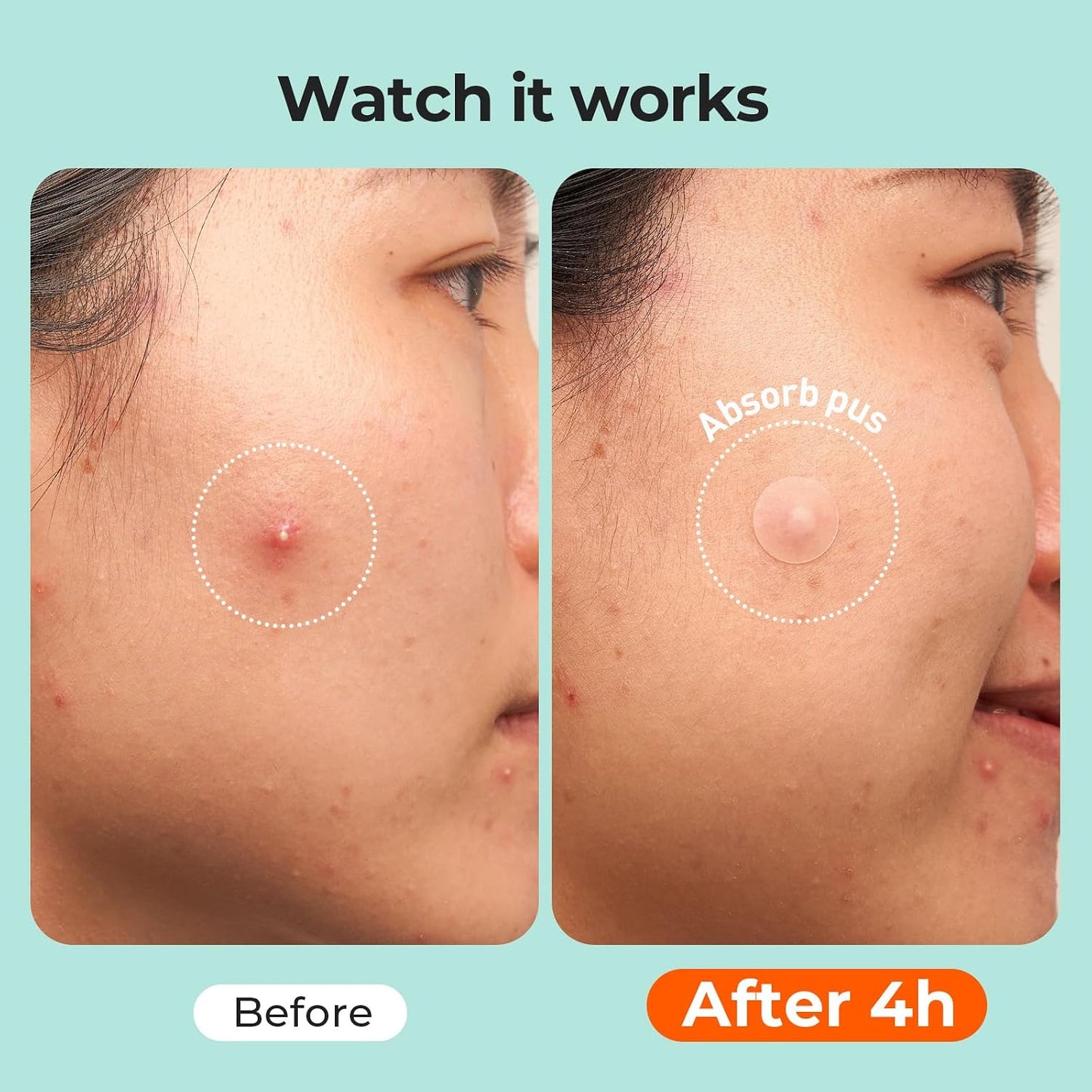 minimal 4-hour wear time with overnight-friendly adhesion