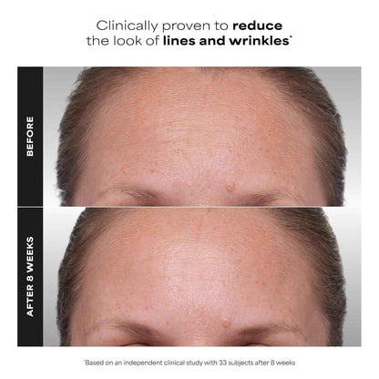 Paula's Choice CLINICAL 1% Retinol Treatment – Nightly Anti-Aging Ritual for Women 35+