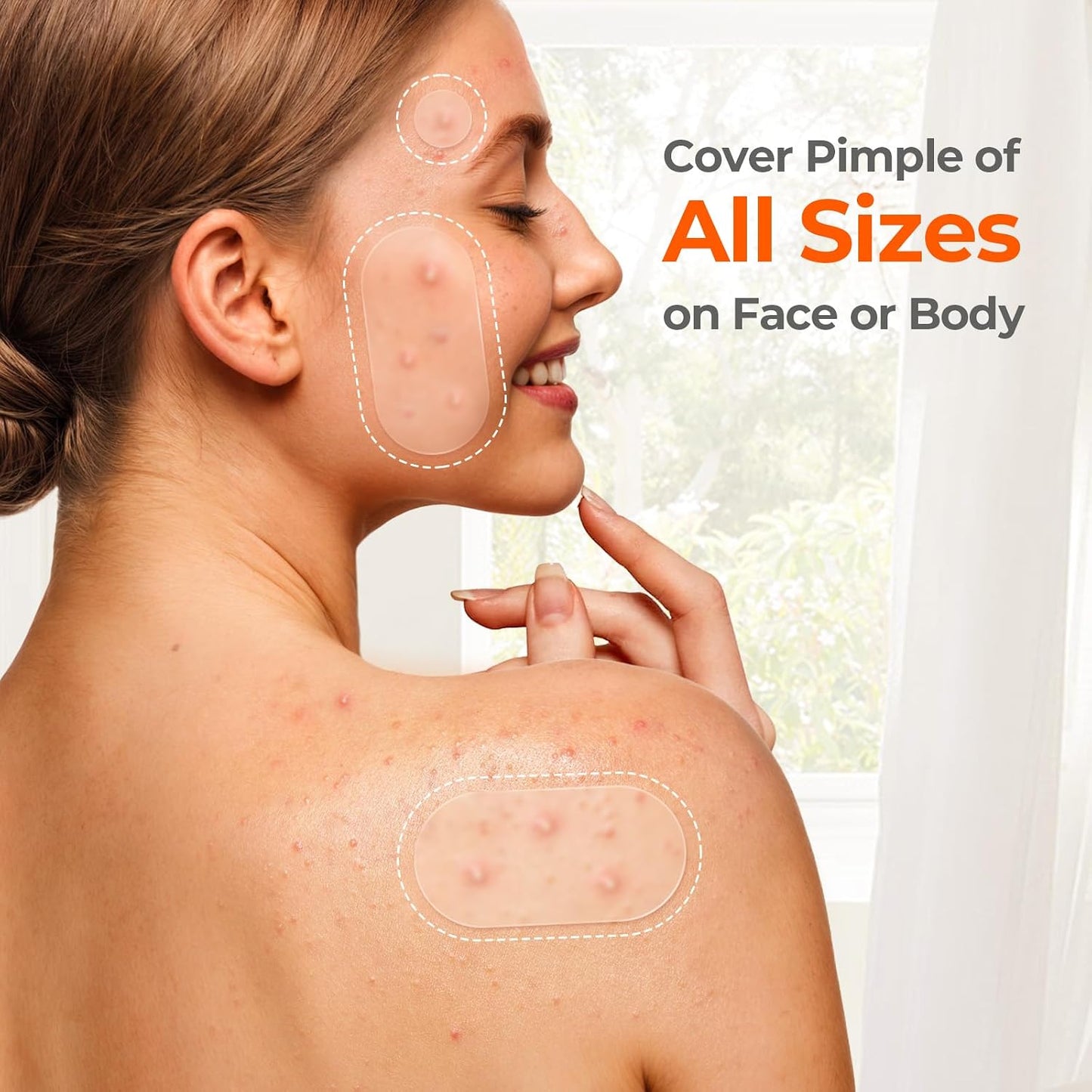 TKTK Hydrocolloid Acne Stickers – Allergy-Friendly Blemish Treatment Safe for Reactive Skin