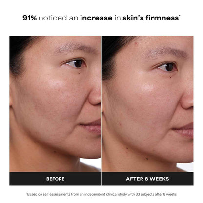 Paula's Choice CLINICAL 1% Retinol Treatment – Nightly Anti-Aging Ritual for Women 35+