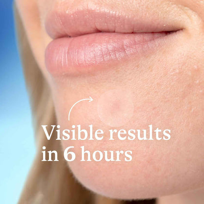 Differin Acne Patches – Clean, Invisible Design for Intentional Skincare Routines